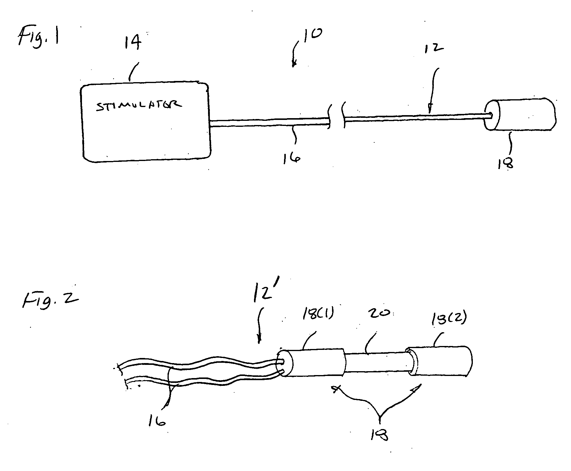 Method of intravascularly delivering stimulation leads into brain