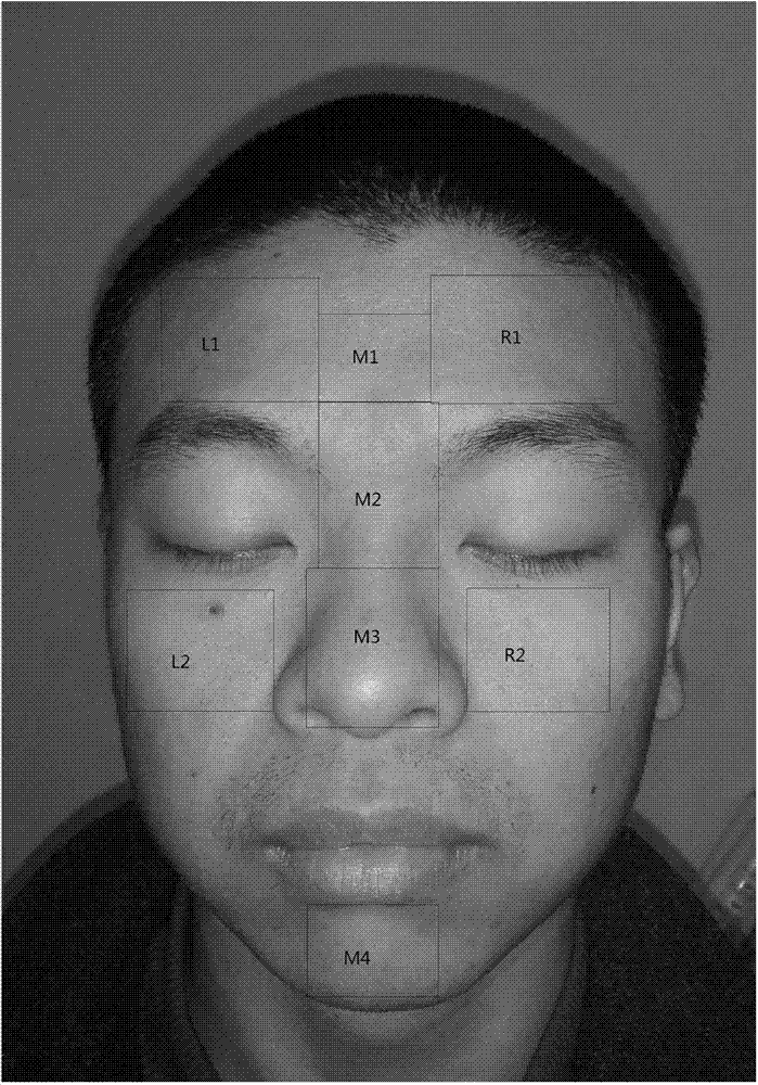 Quantification skin detecting method based on face image recognition