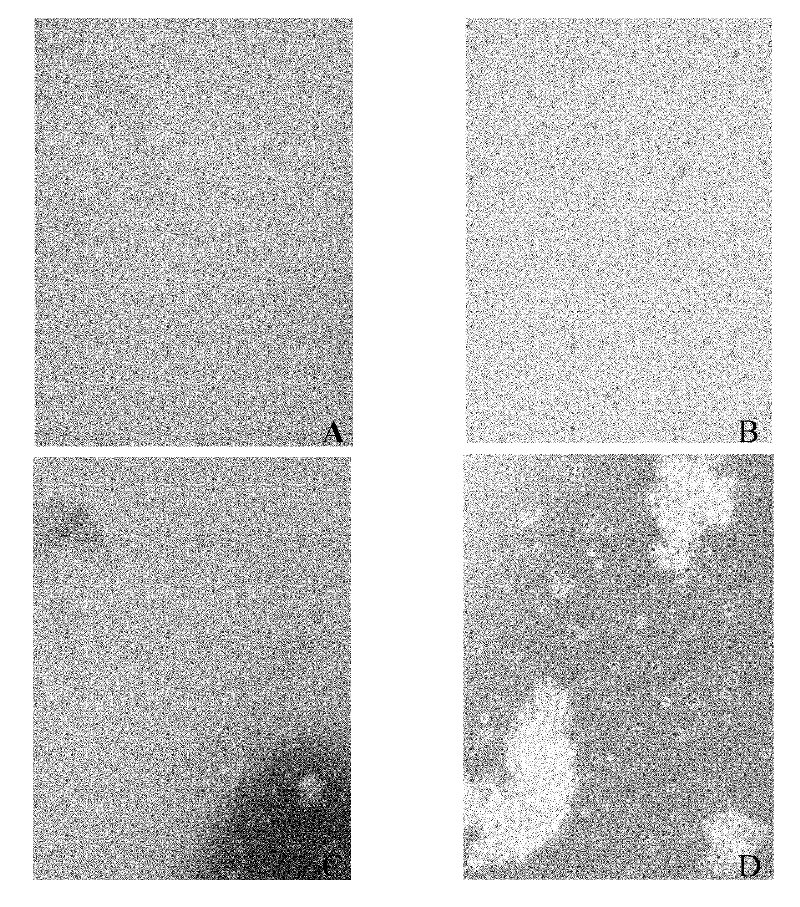 Human umbilical cord mesenchymal stem cell (HUMSC) anti-hepatic fibrosis injection and preparation method thereof