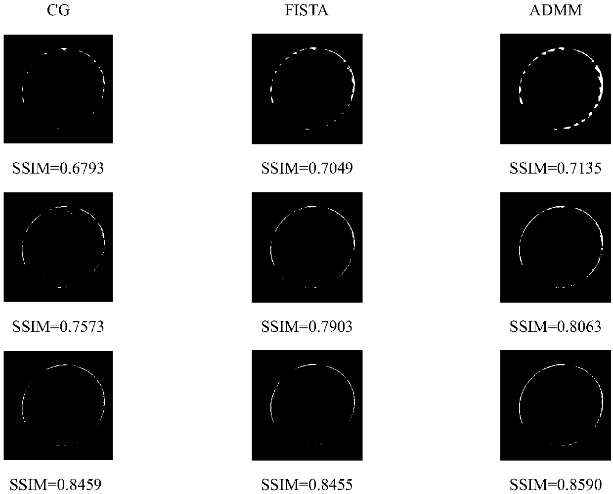 MRI image reconstruction method