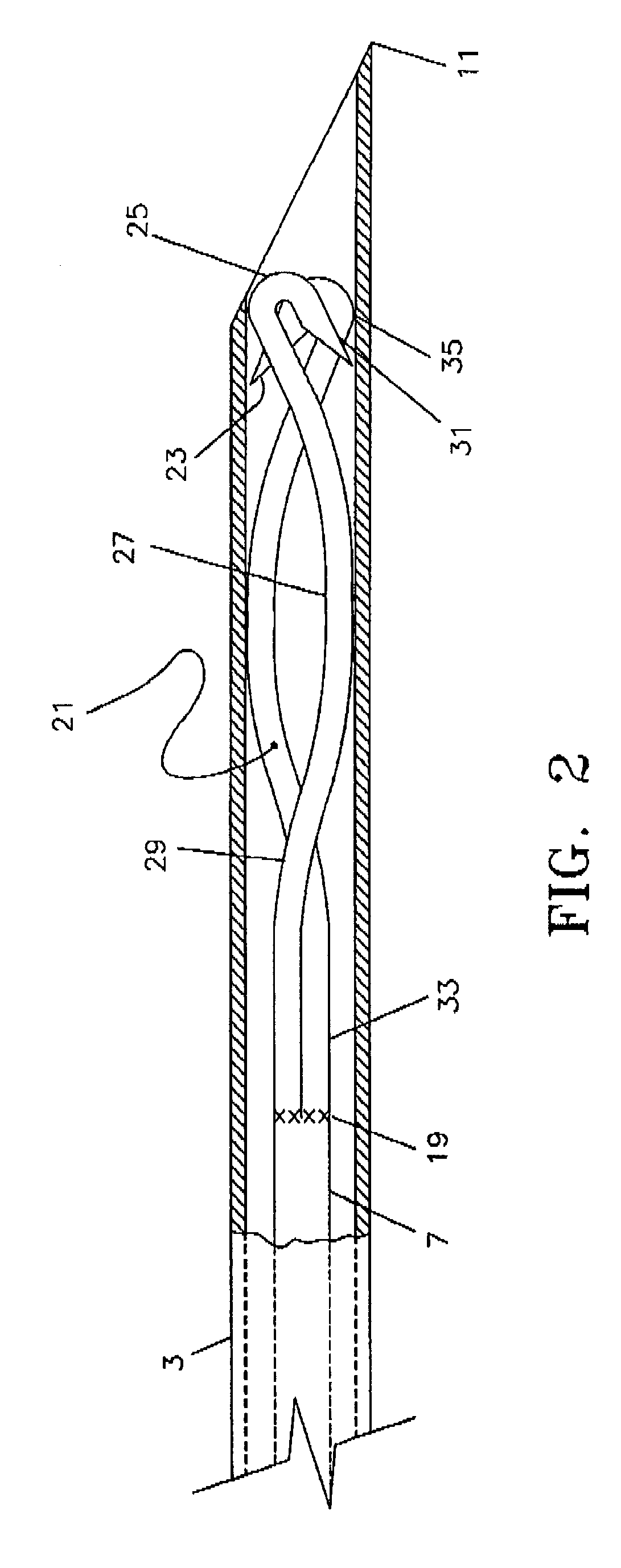Device and method for withdrawing a tubular body part
