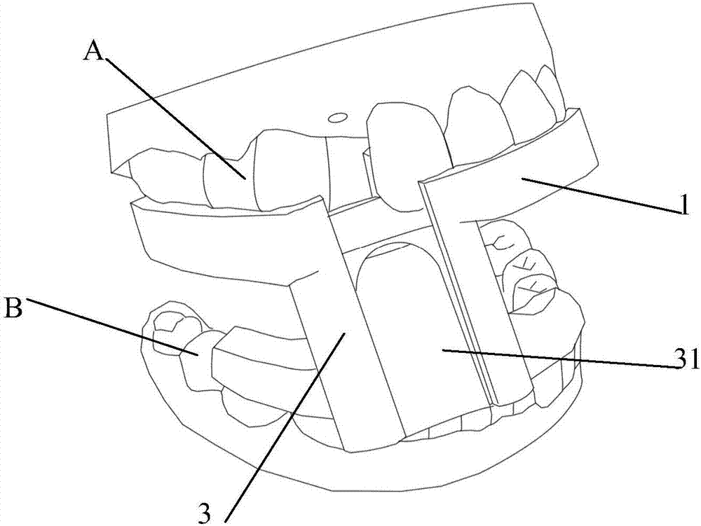 Tooth articulation control machine head guide plate and a production method thereof