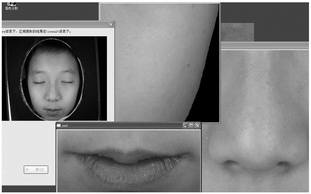 TCM face-to-face analysis and diagnosis system