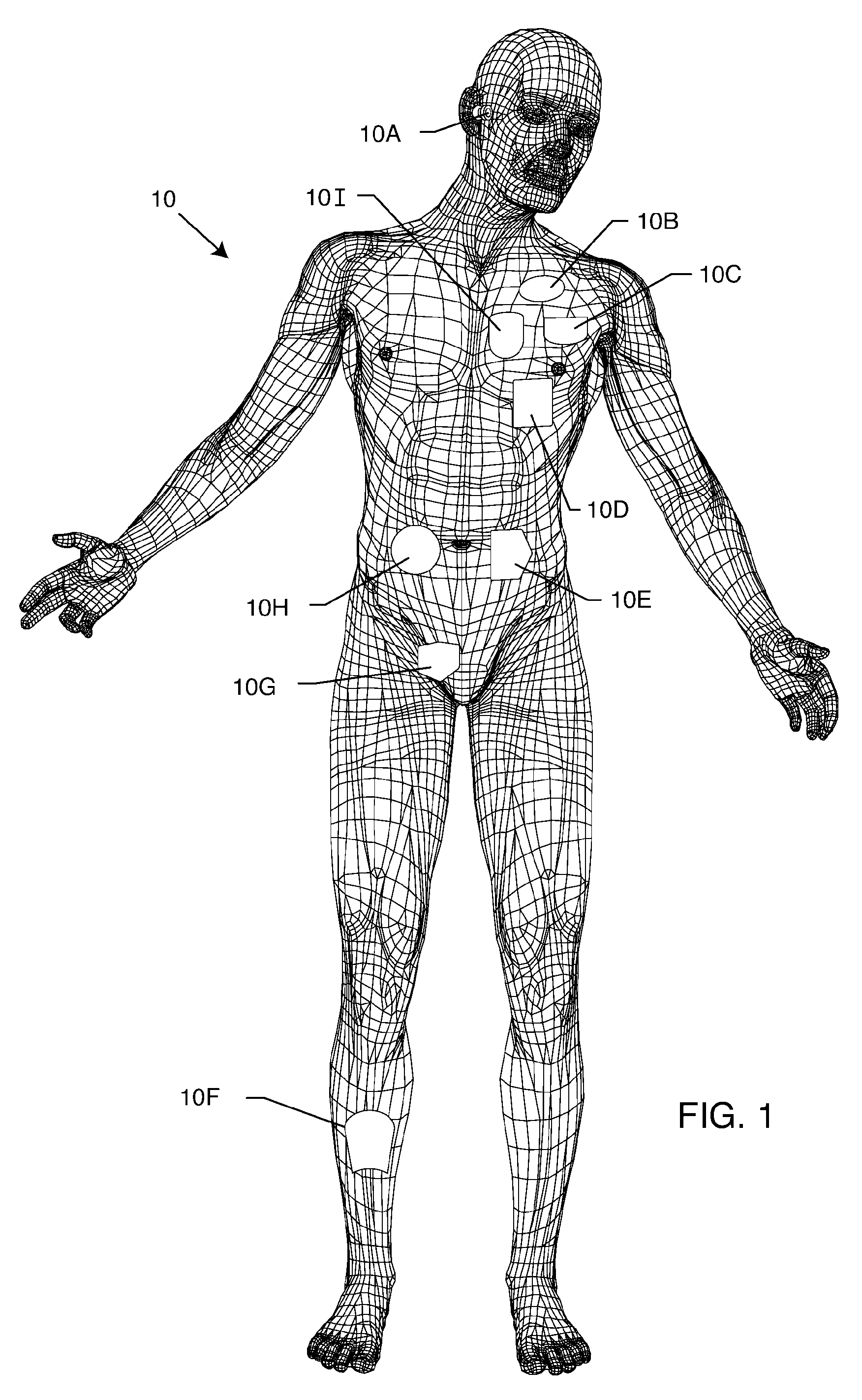 Device to protect an active implantable medical device feedthrough capacitor from stray laser weld strikes, and related manufacturing process