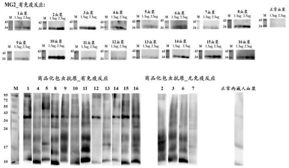 Recombinant protein of human echinococcosis antigen and application thereof