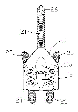 Cervical vertebra fixing plate with odontoid process fusing device