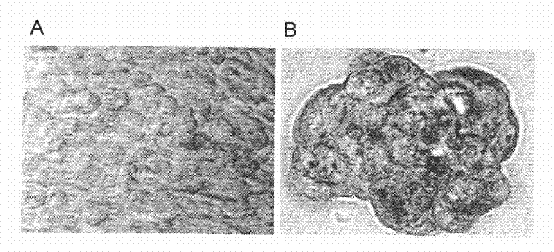 Anti-tumor medicament for promoting tumor cell senescence and preparation method thereof