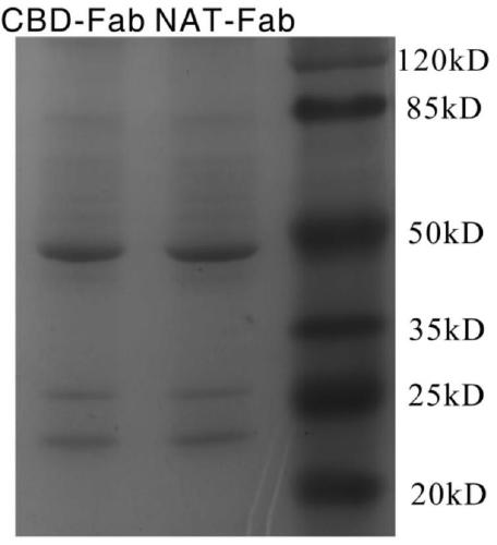 Therapeutic recombinant antibody, its coding gene and application