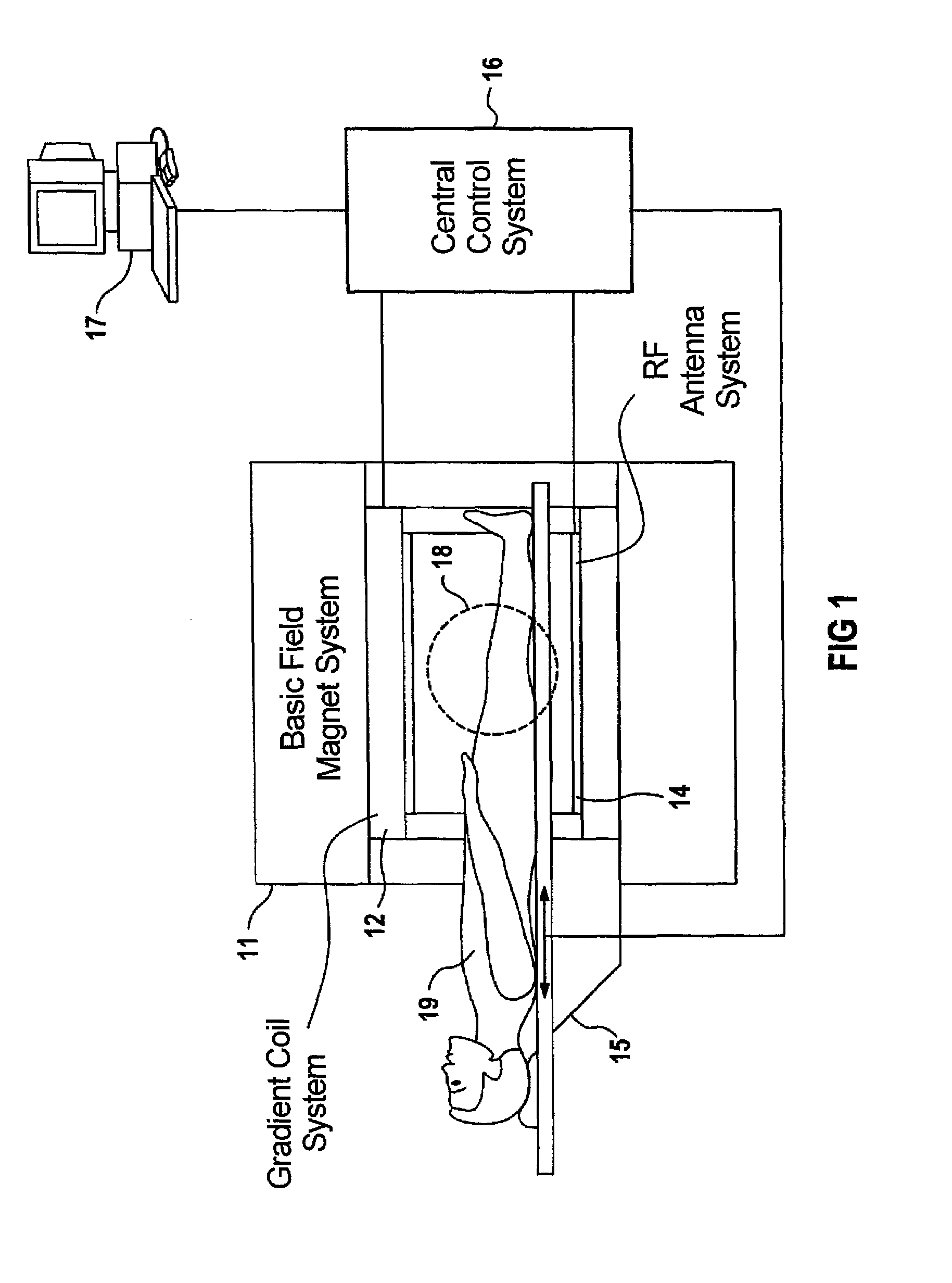 Double echo magnetic resonance imaging sequence and apparatus for the implementation thereof