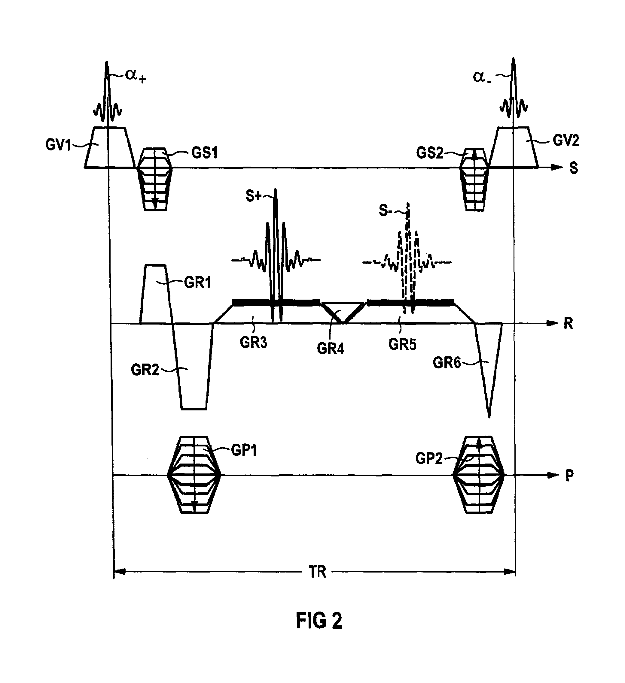 Double echo magnetic resonance imaging sequence and apparatus for the implementation thereof