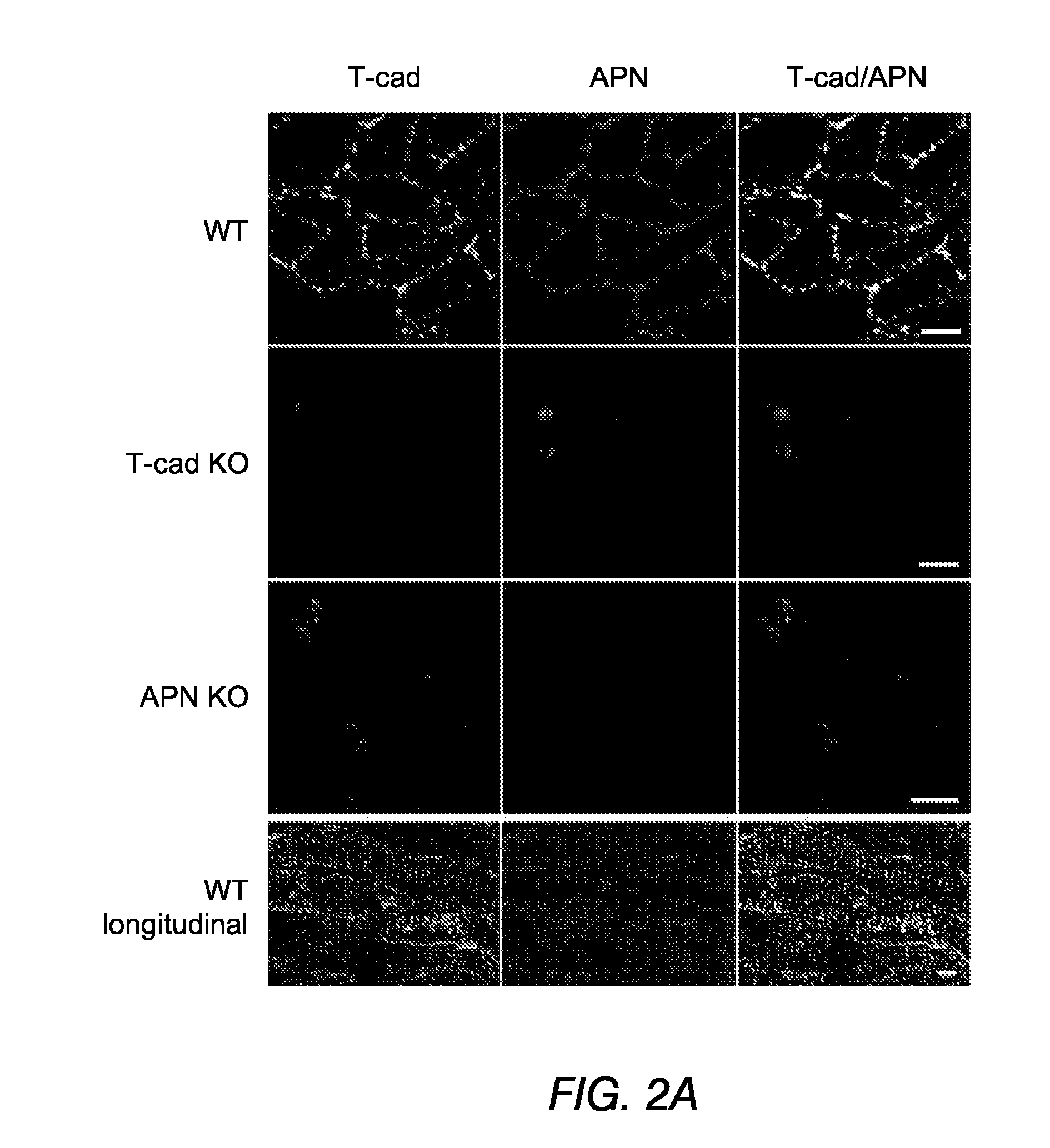 Methods, compositions and transgenic models related to the interaction of t-cadherin and adiponectin