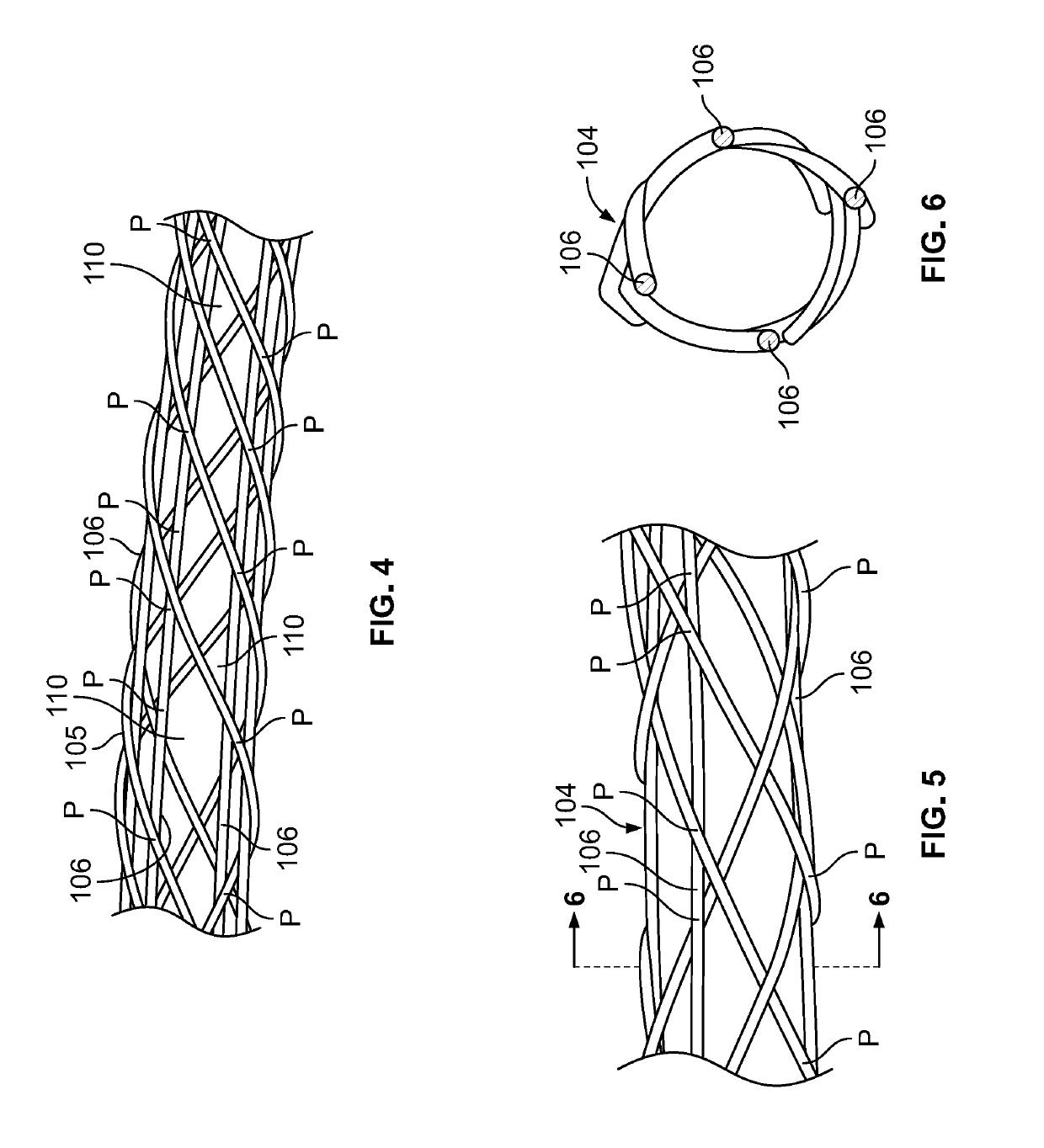 Indirect attachment of a needle to a mesh suture