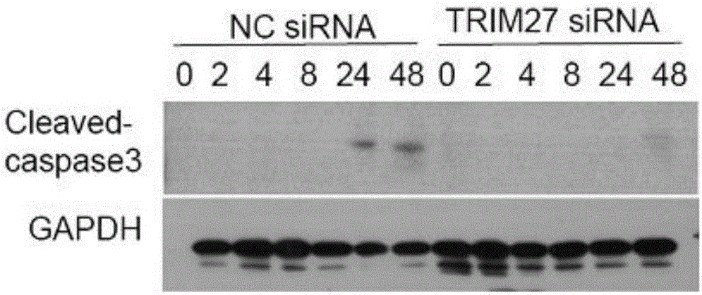 Protein TRIM27 resistant to mycobacterium tuberculosis infection