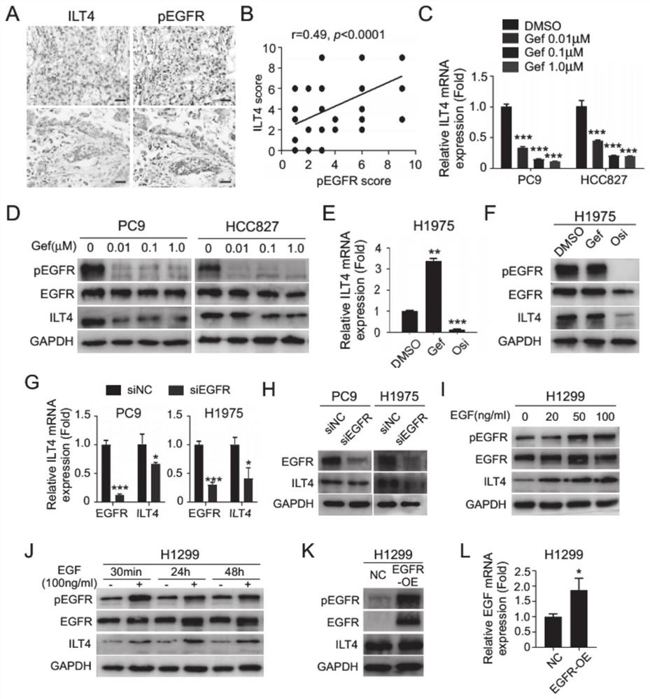 Application of ILT4 in EGFR activated non-small cell lung cancer treatment