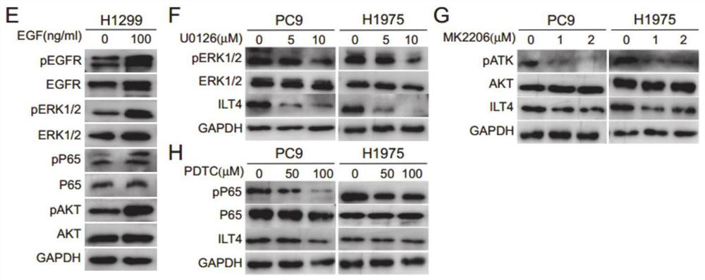 Application of ILT4 in EGFR activated non-small cell lung cancer treatment