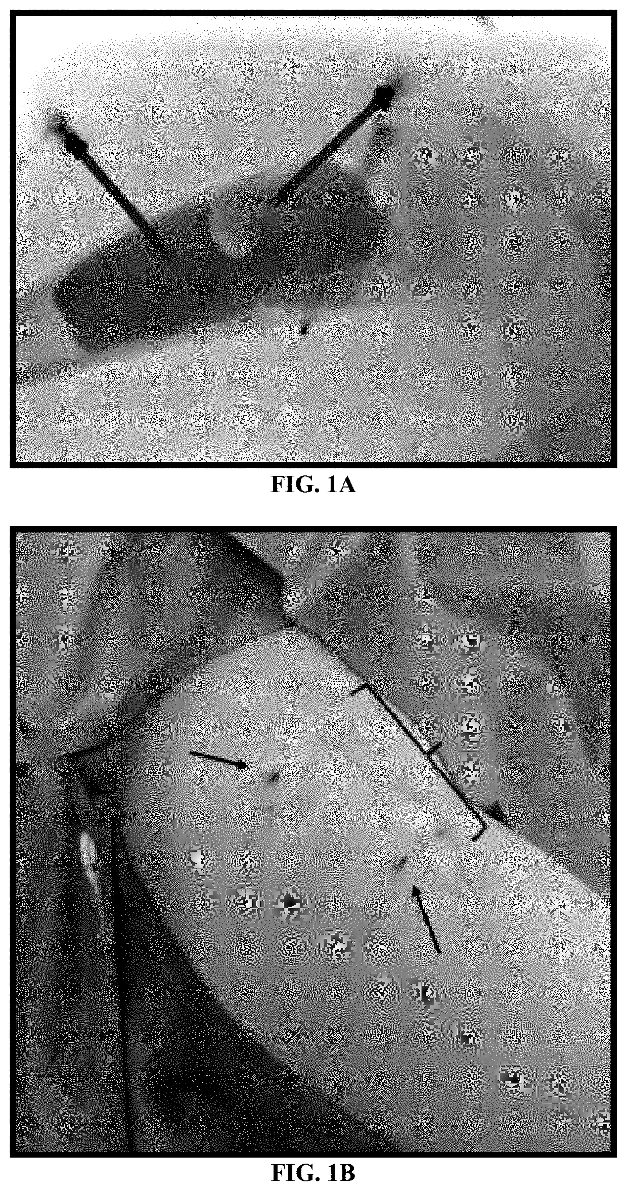 System and Method for Treatment of Bone