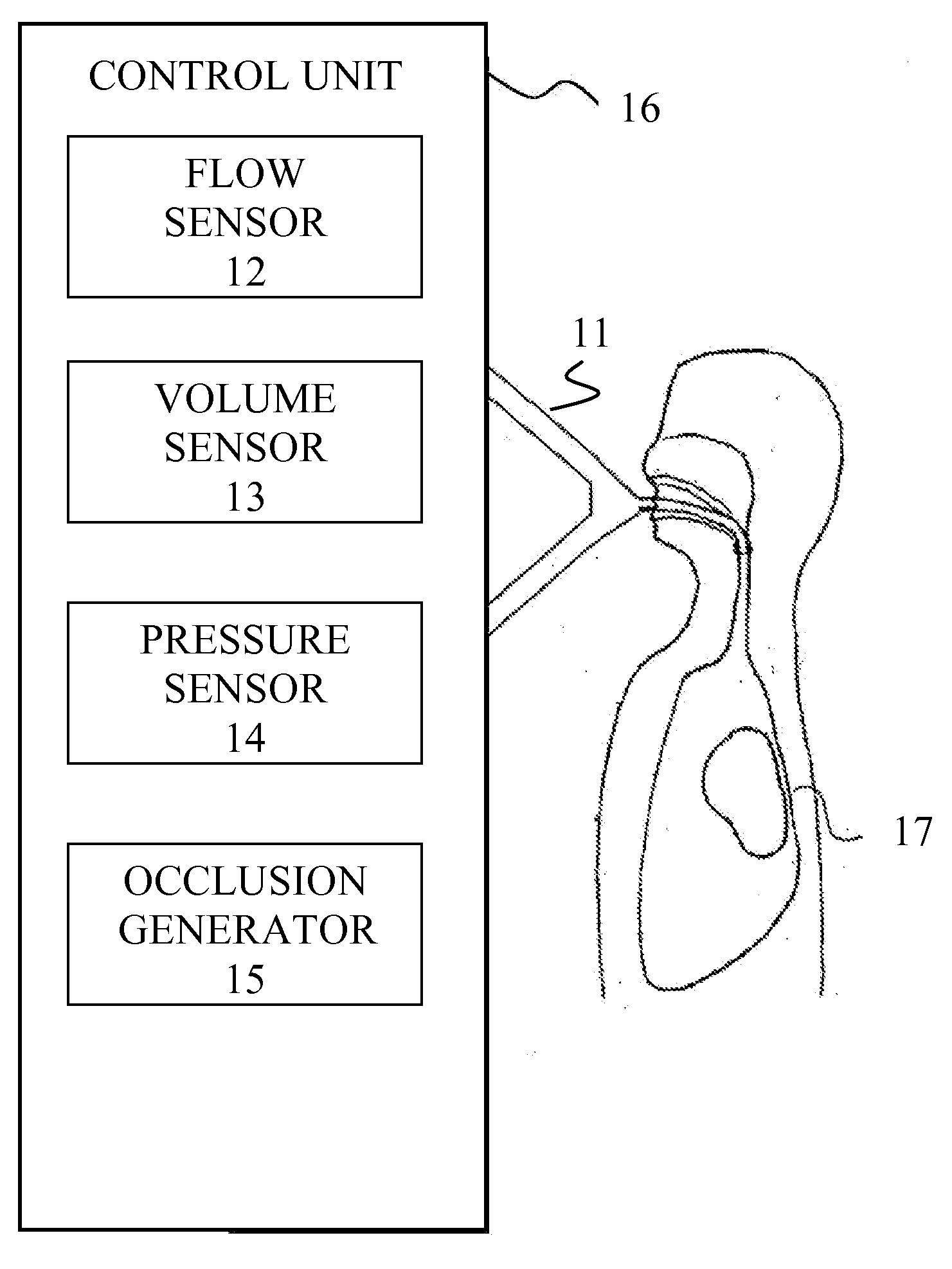 Method for determining the resistance of the respiratory system of a patient