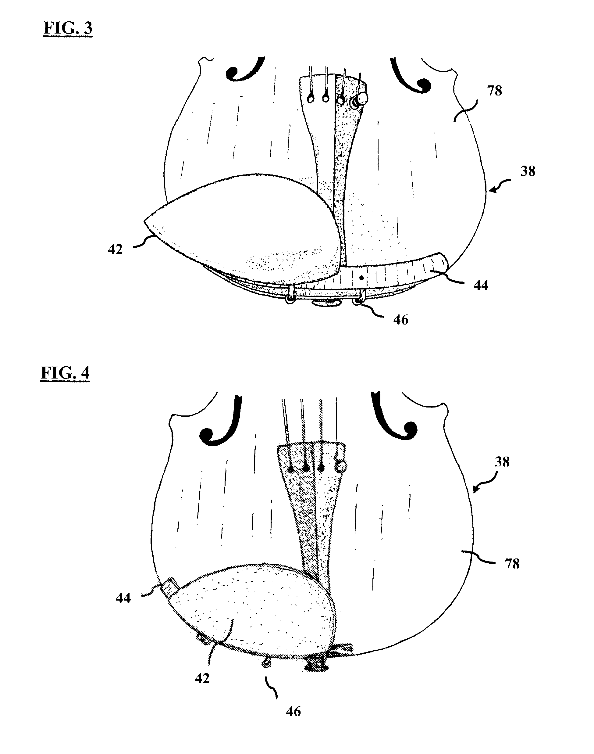 Chinrest device for musical instrument, method and kit