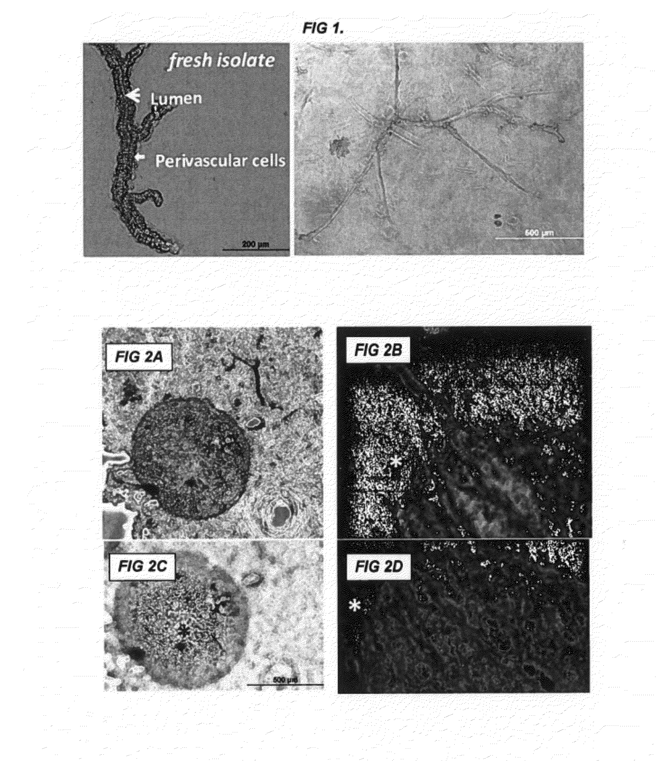Methods and compositions to support transplanted tissue integration and innosculation with adipose stromal cells