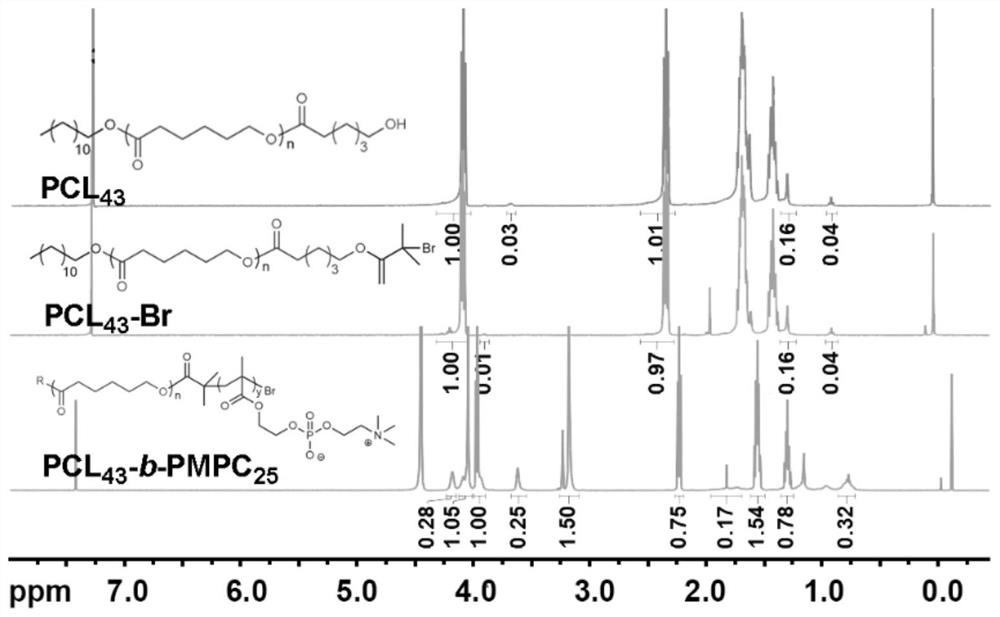 Phospholipid-like amphiphilic block copolymer-based ultrasonic contrast agent and preparation method thereof