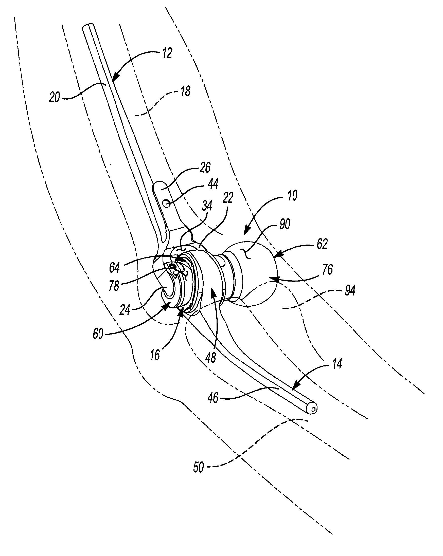 Adjustable lateral articulating condyle