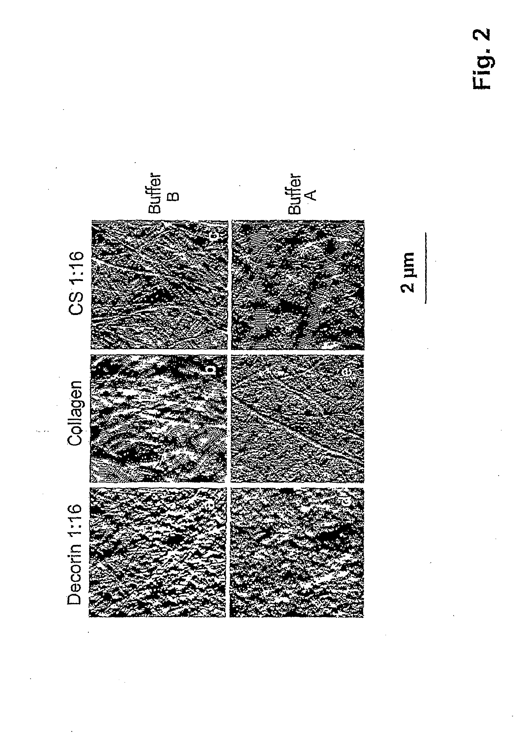 Osteogenic composite matrix, method for the production thereof and implant and scaffold for tissue engineering provided with a coating formed by said osteogenic composite matrix