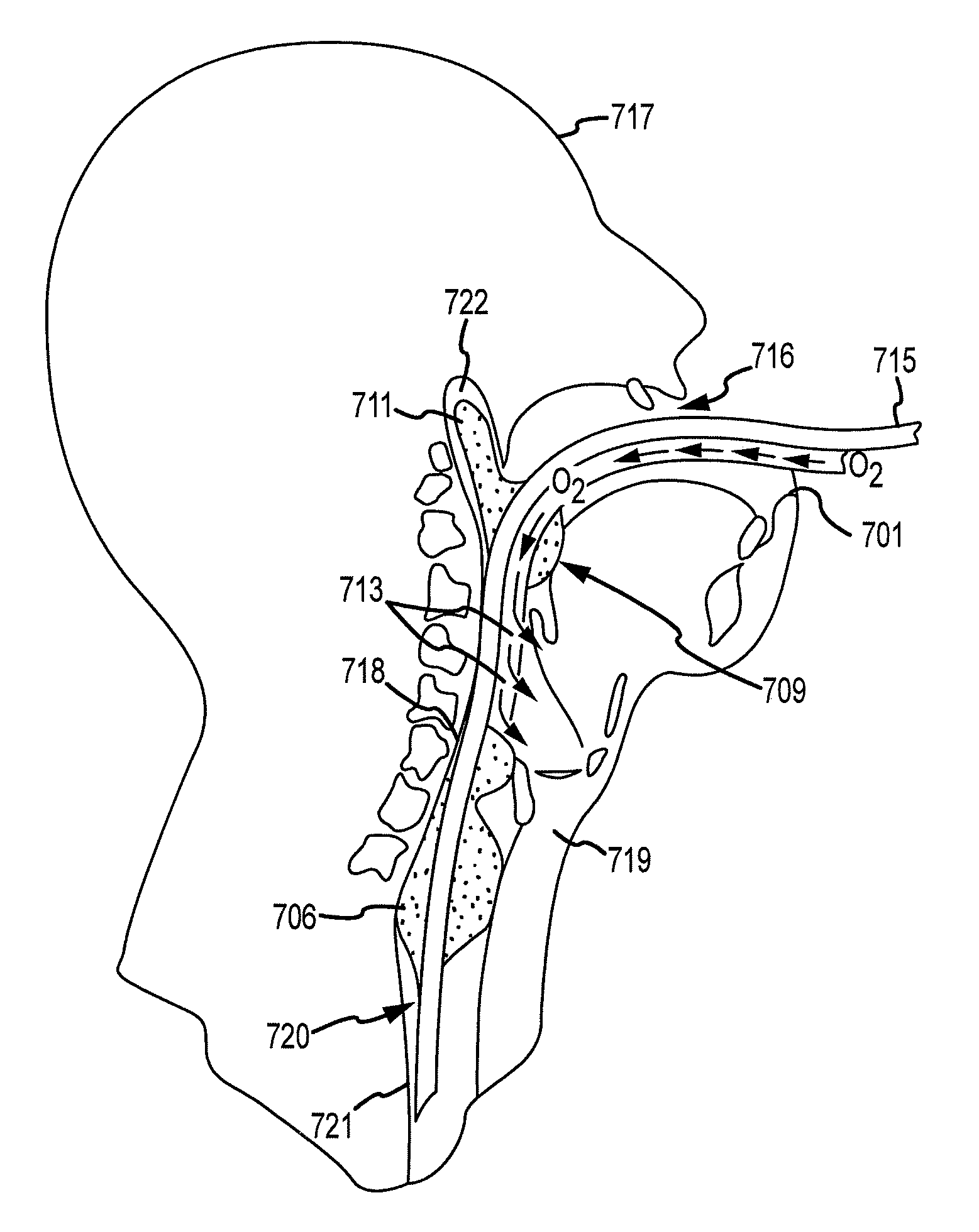 System, method, and device to increase circulation during cpr without requiring positive pressure ventilation