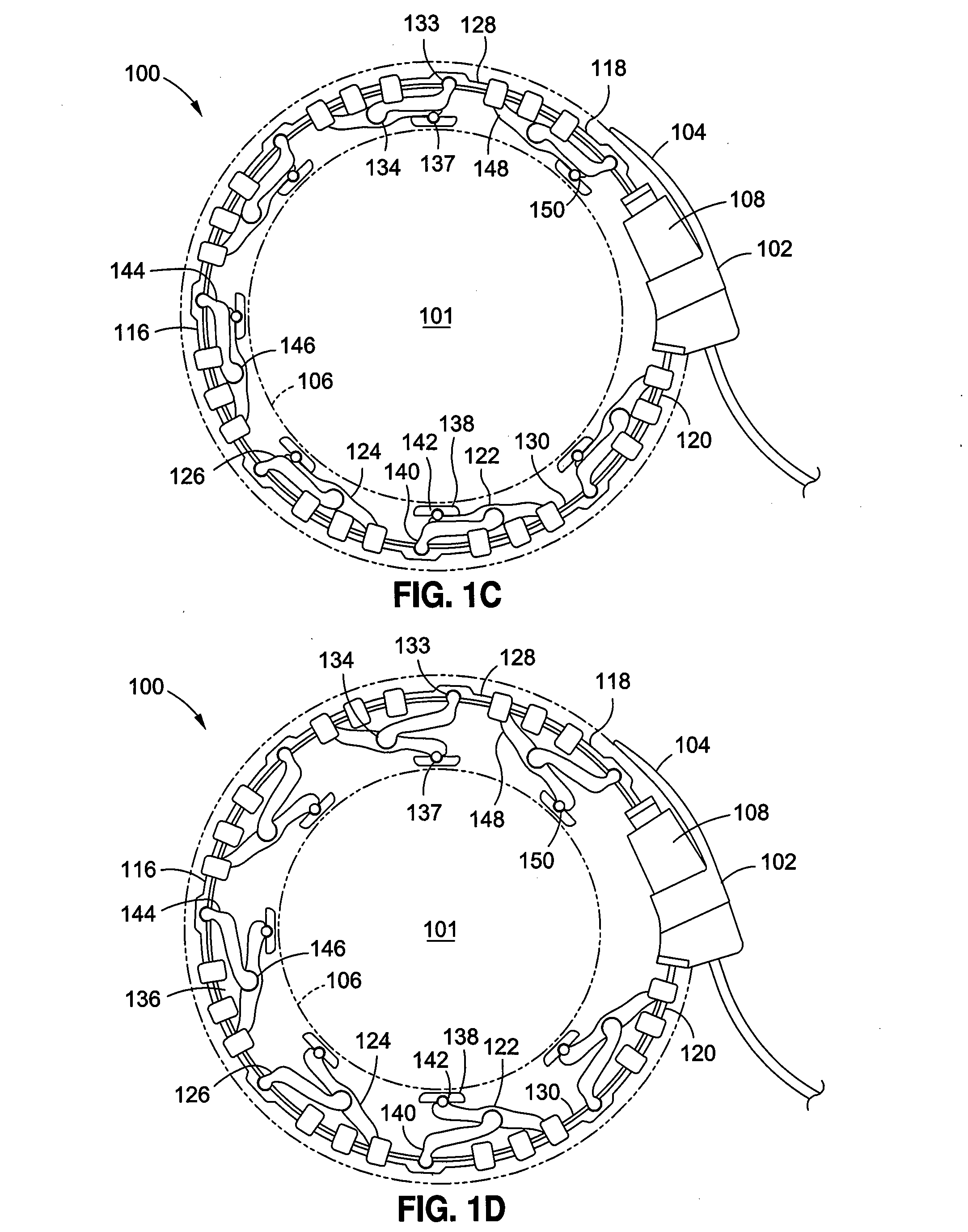 Gastric band devices and drive systems