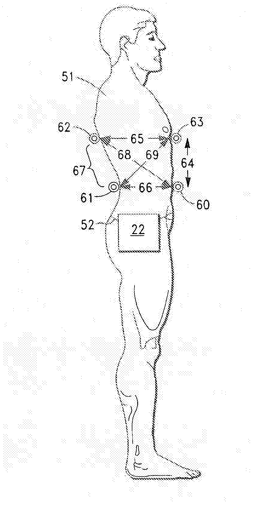 Noninvasive method and system for measuring pulmonary ventilation