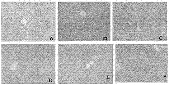 A kind of medicine for treating non-alcoholic fatty liver and its application