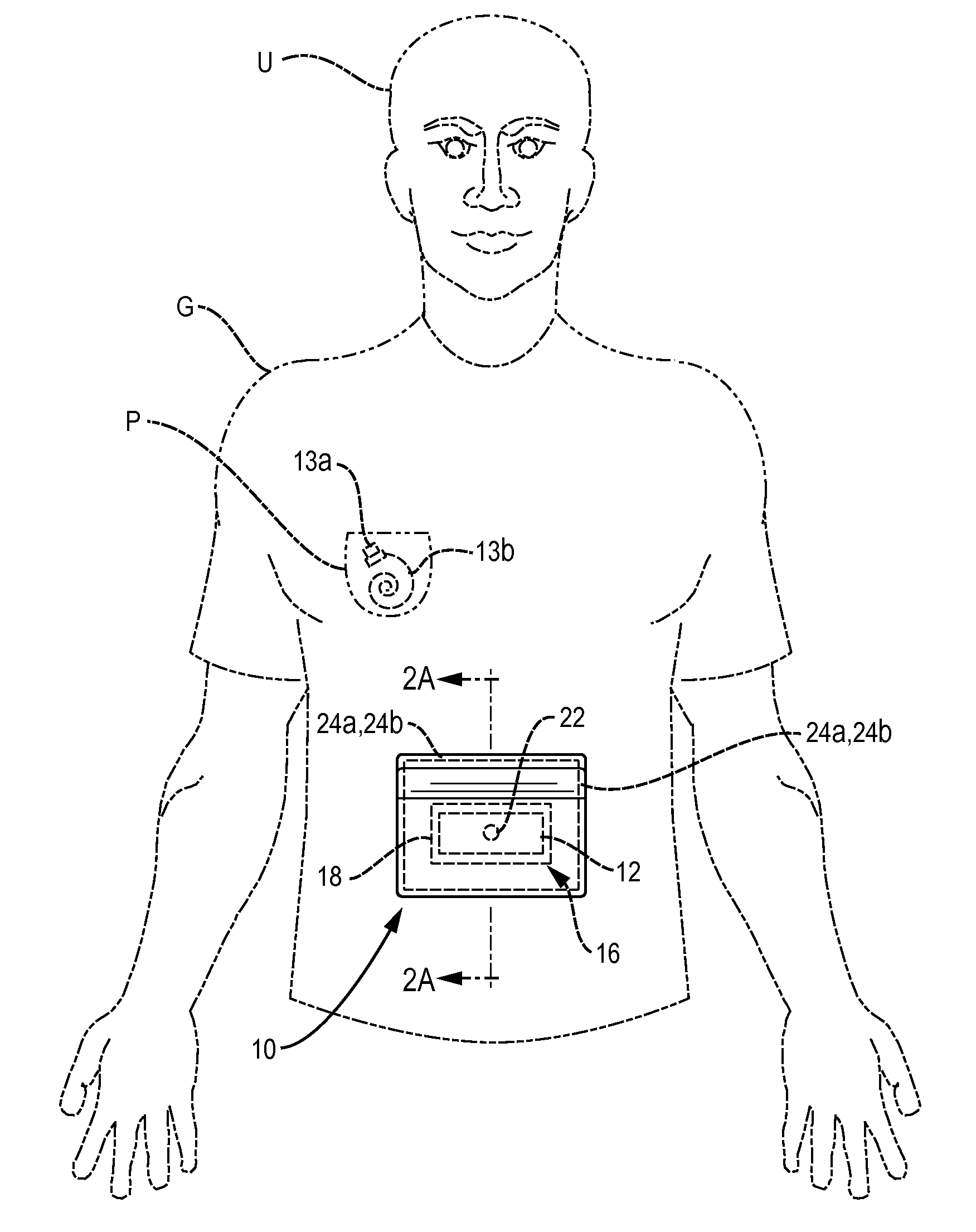 User interface securing assembly