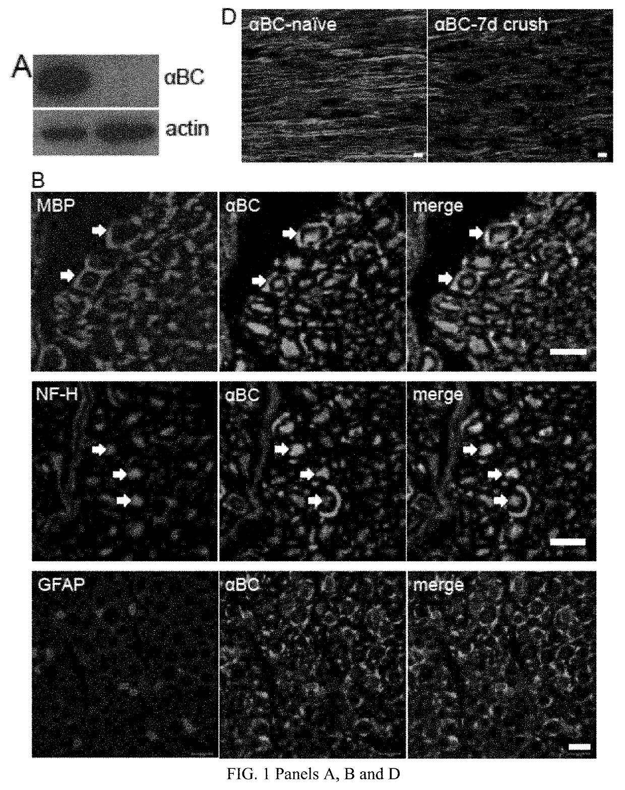 Methods for treating peripheral nerve injury