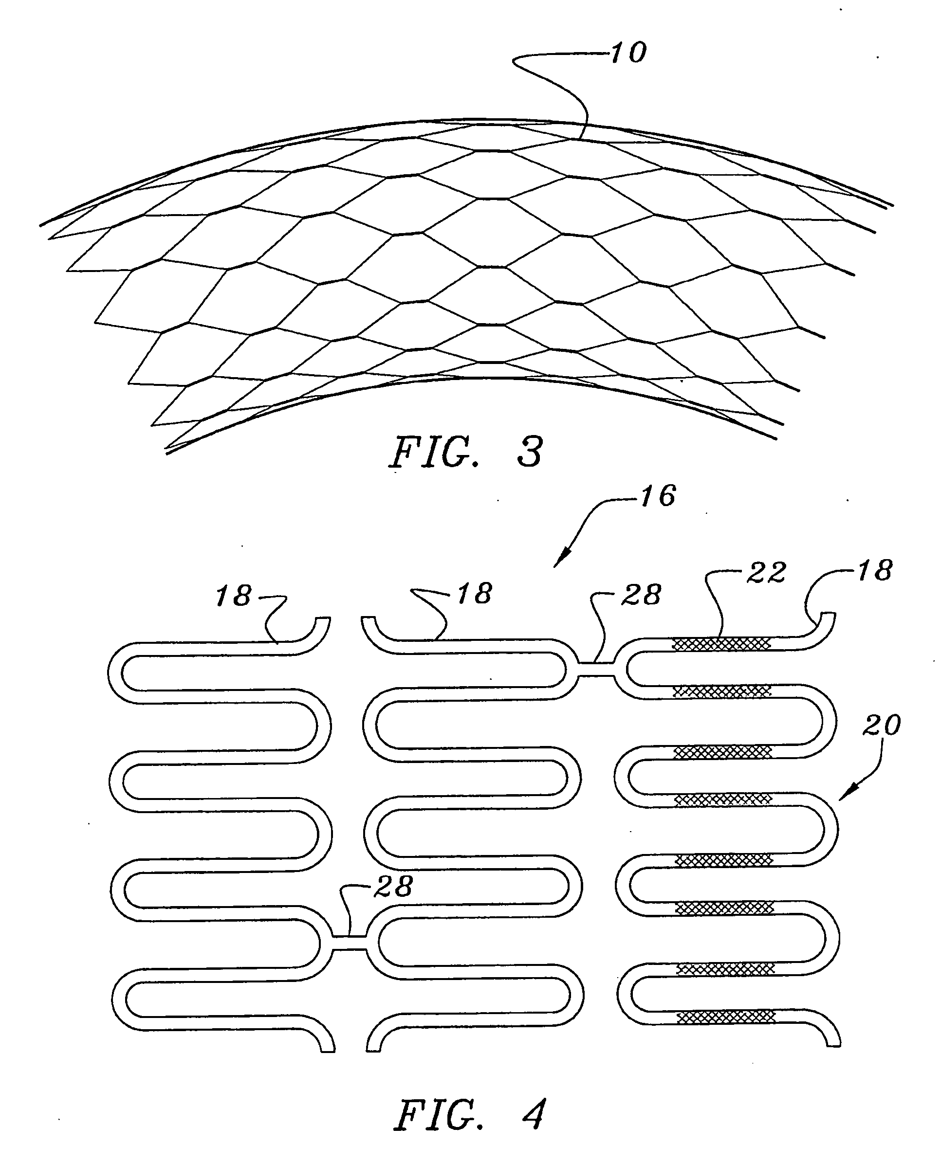 Structurally variable stents