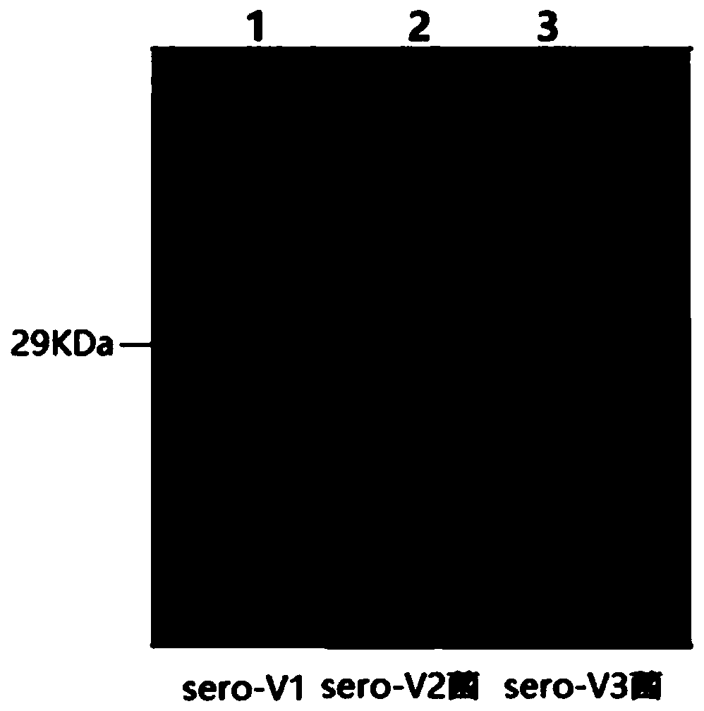 Composition containing group B meningococcal fHBP antigen as well as preparation method and application thereof