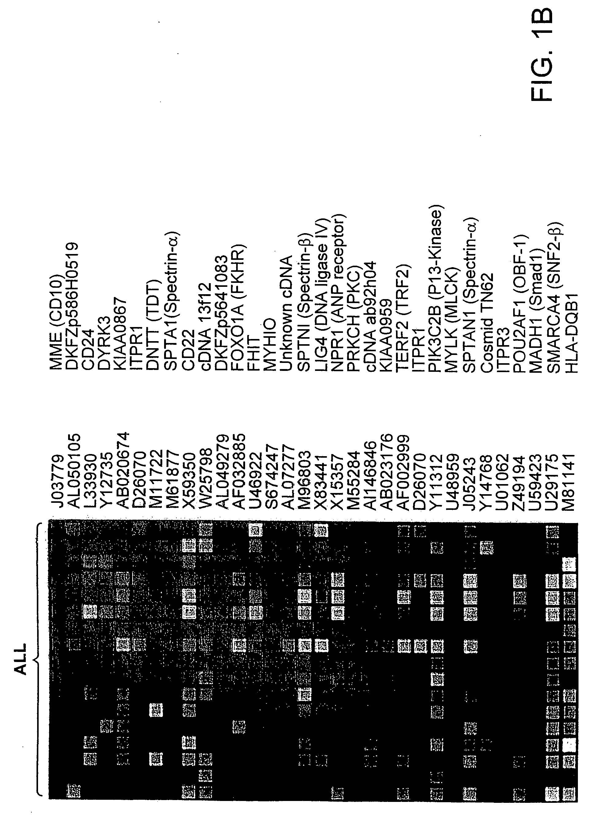 MLL translocations specify a distinct gene expression profile, distinguishing a unique leukemia