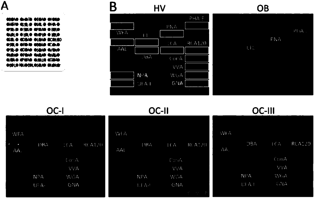 Application of specific lectin composition in preparing test carrier for identifying epithelial ovarian cancer, and kit