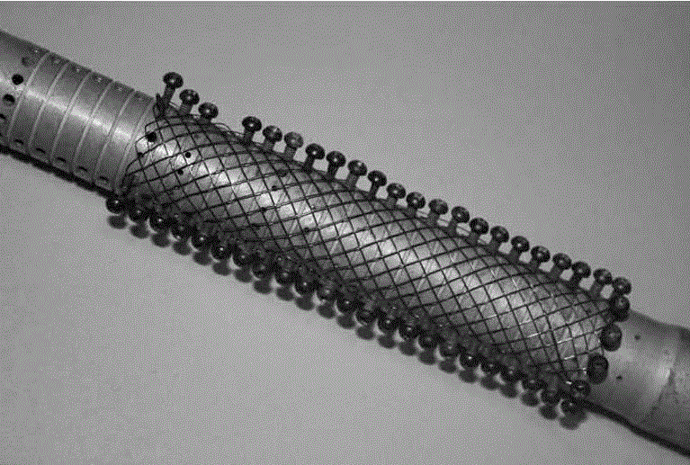 Preparation method for detachable esophageal stent