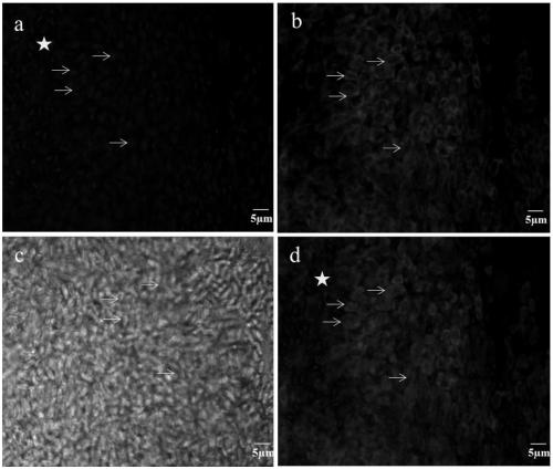 Specific marker Nagorno-Karabakh deformation microsporidia nucleic acid probe and fluorescence in-situ hybridization detection method thereof