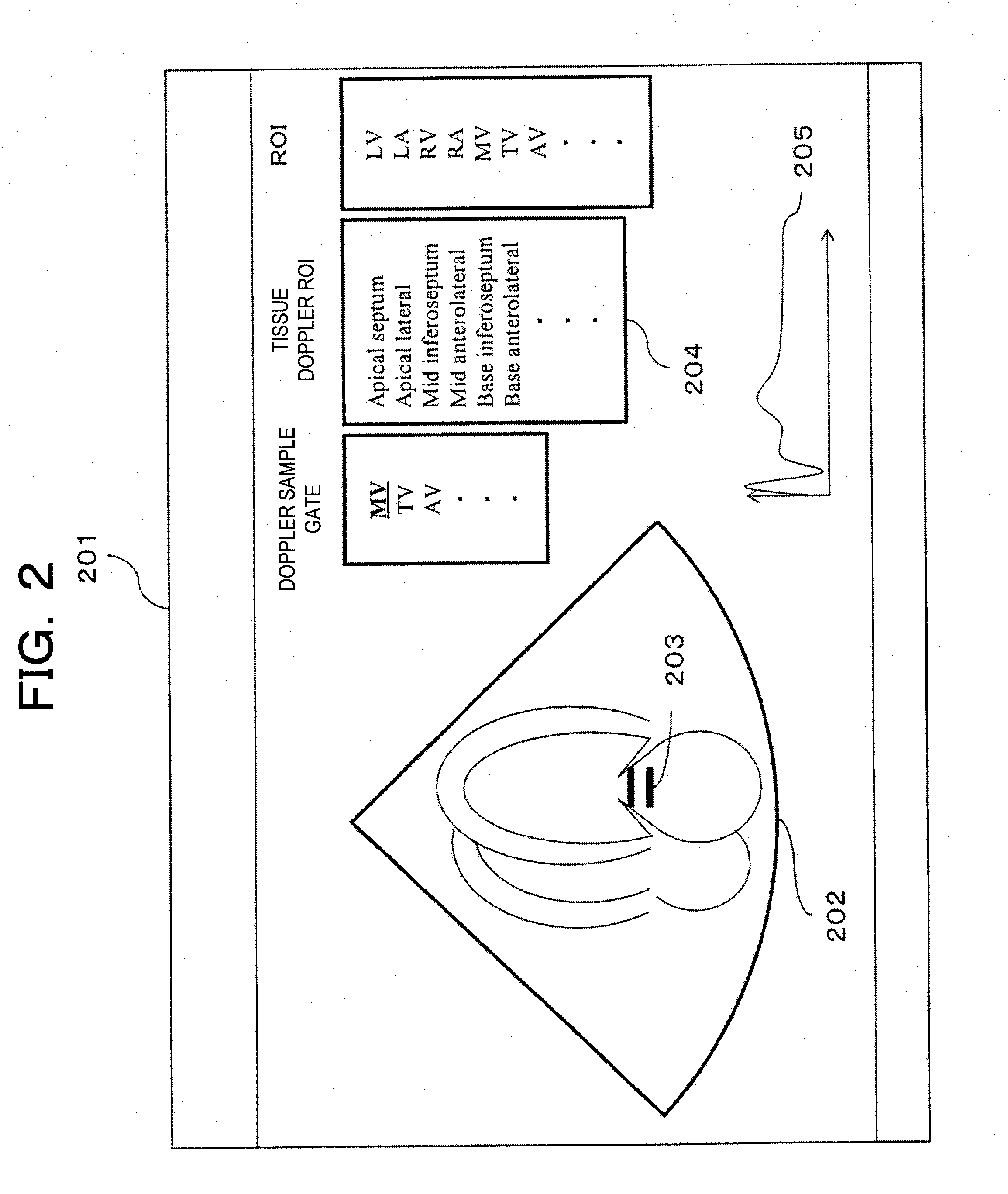 Medical image dianostic device, region-of-interst setting method, and medical image processing device