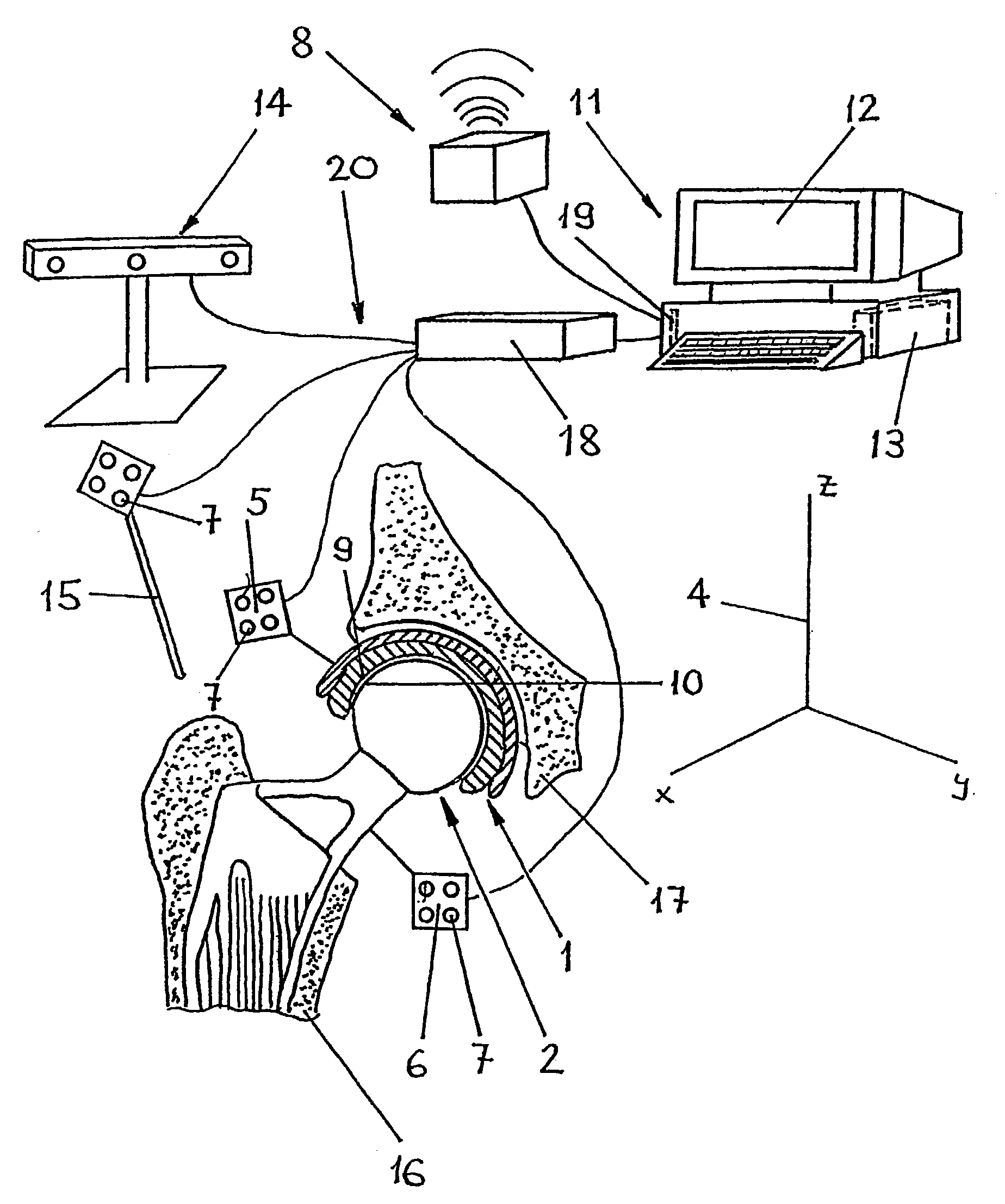 Method and device for impingement detection
