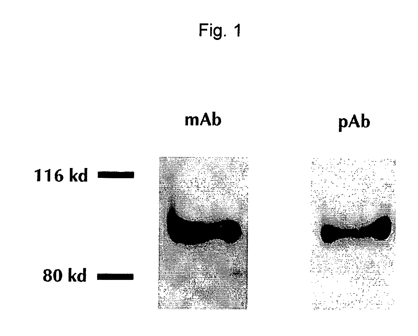 Methods and Compositions for Detecting Pancreatic Disease