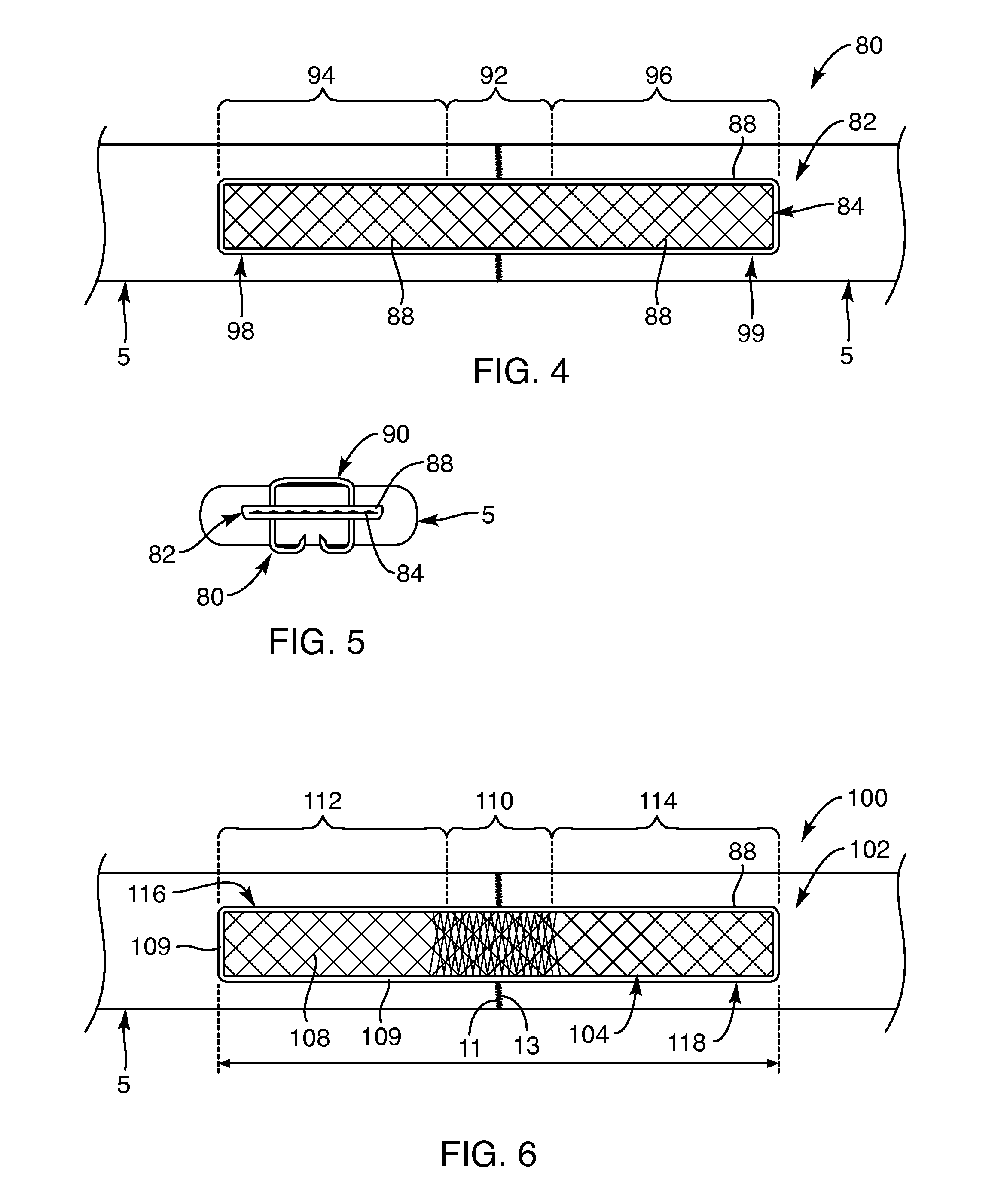 Soft tissue repair devices, systems, and methods