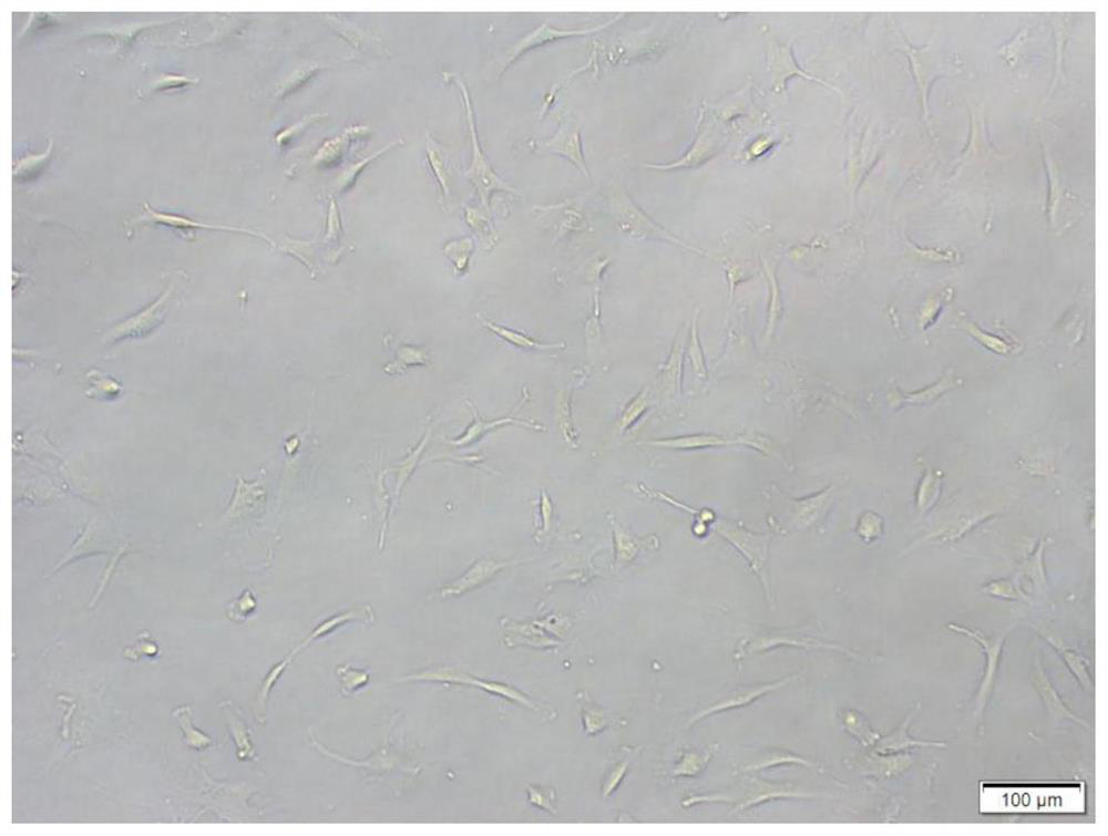 Human chondrocyte culture medium and application thereof