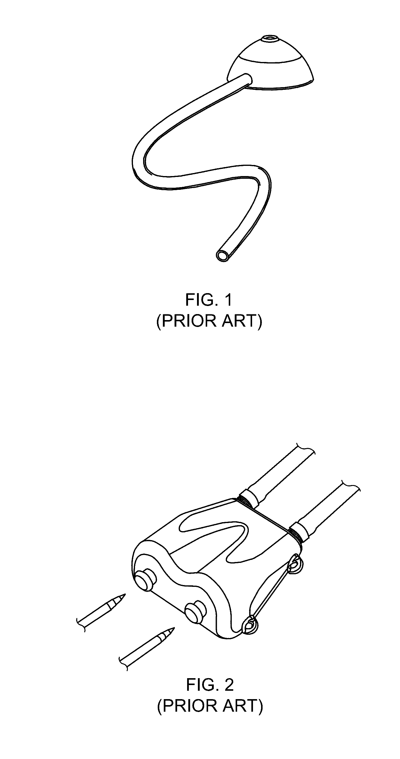 Graft-port hemodialysis systems, devices, and methods