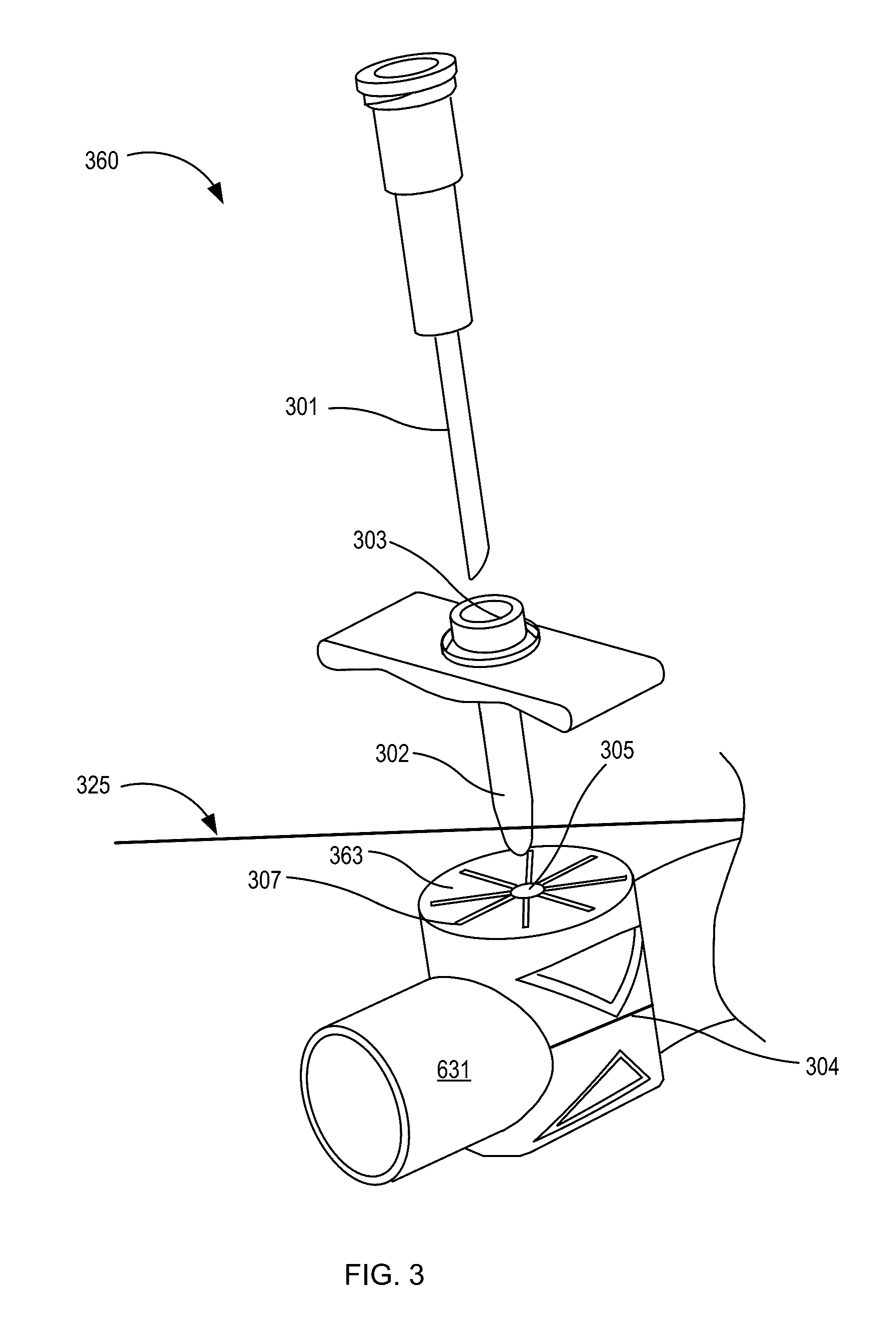 Graft-port hemodialysis systems, devices, and methods