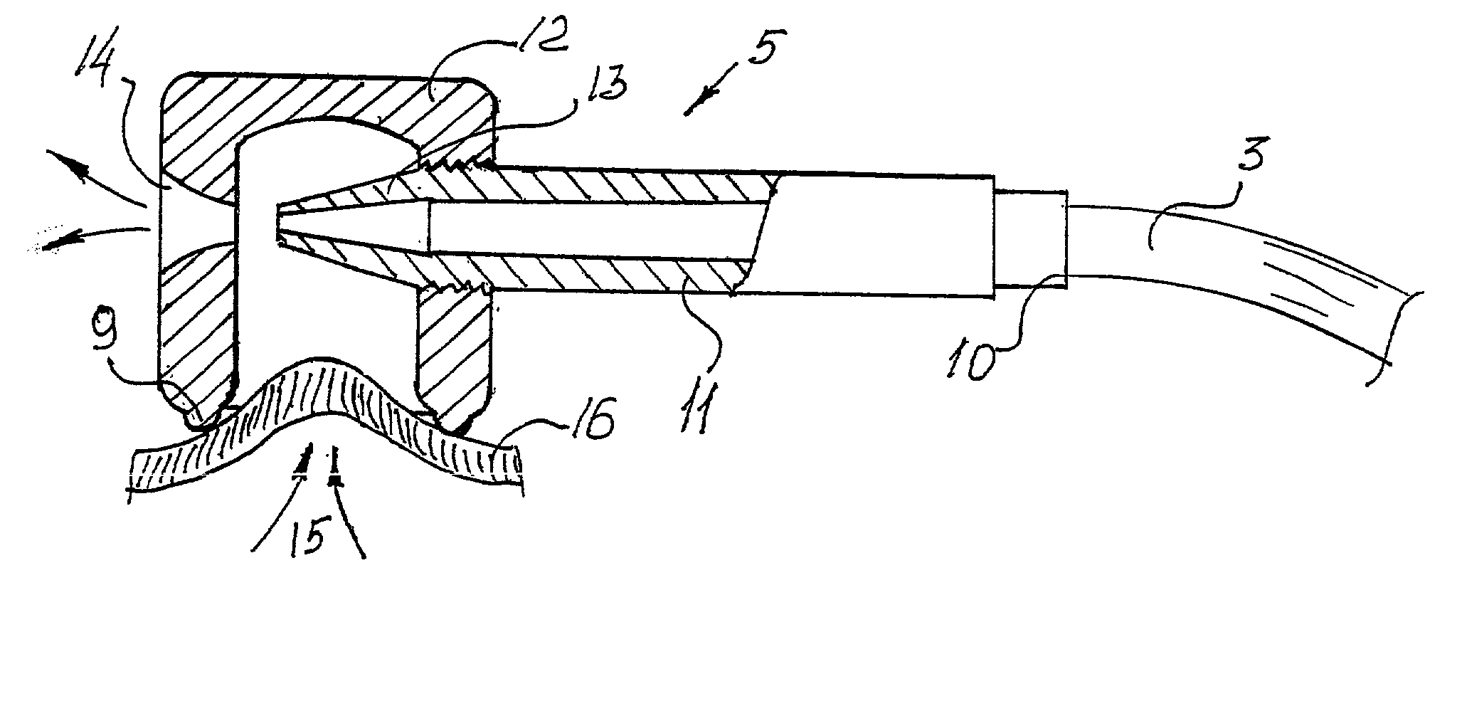 Method and apparatus for hydro-suction vibrational bio-stimulation of a living organism