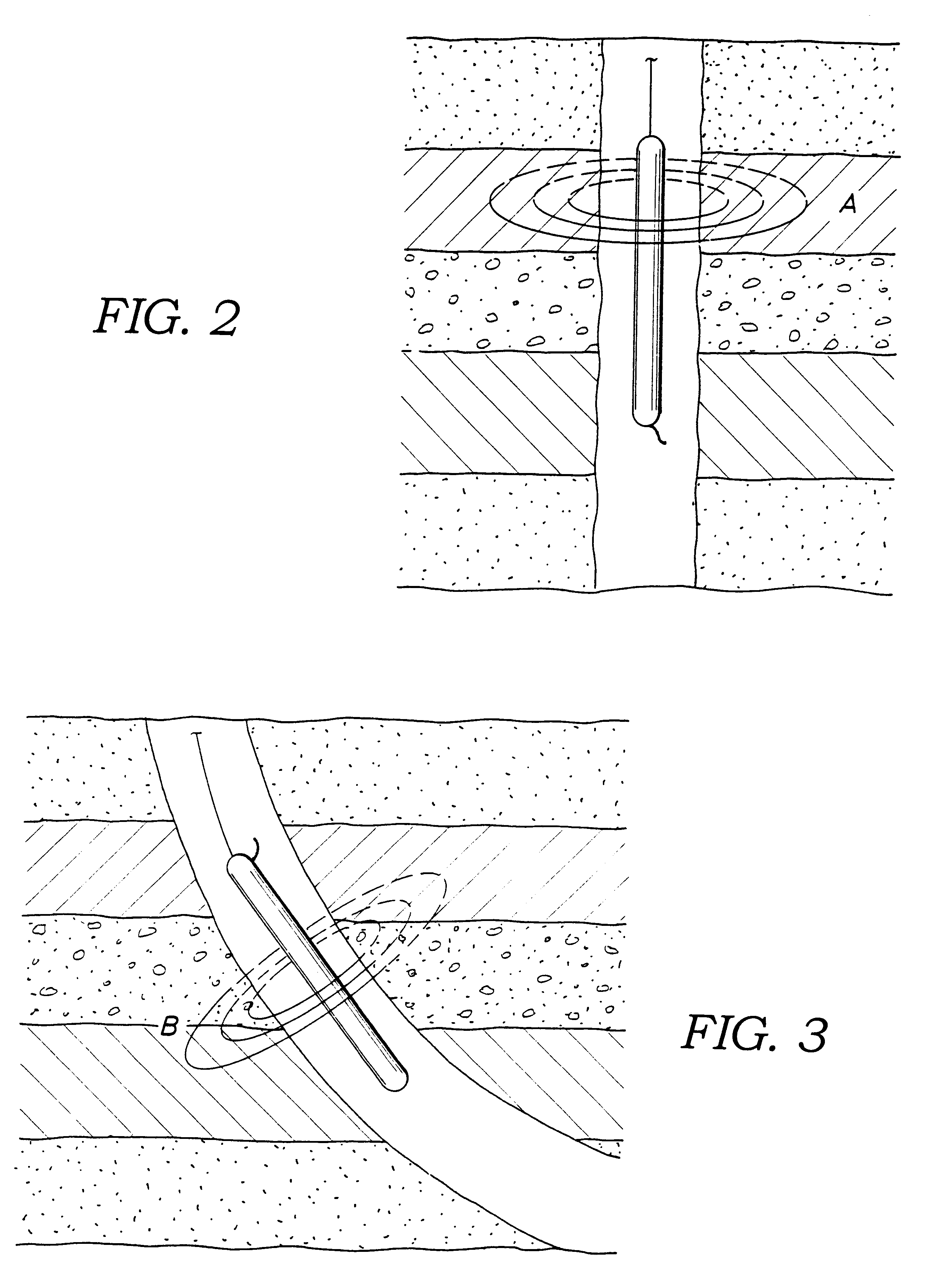 Method and apparatus for evaluating the resistivity of formations with high dip angles or high-contrast thin layers