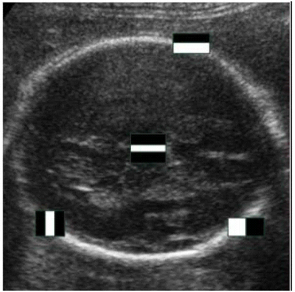 Measurement method for fetus ultrasound image