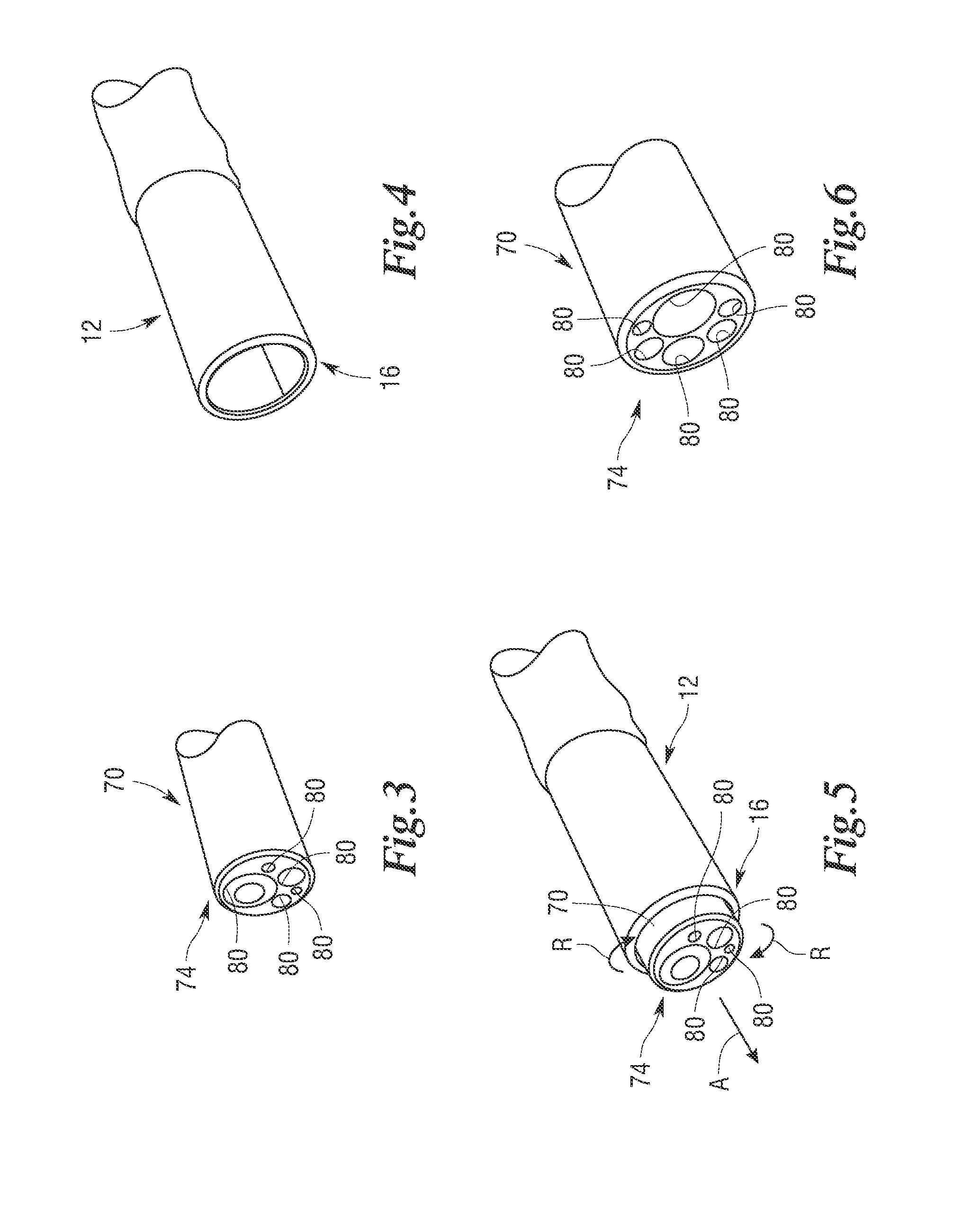 Manipulatable guide system and methods for natural orifice translumenal endoscopic surgery