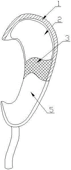 Intraoperative and postoperative auricle intermittent positive pressure inflating device